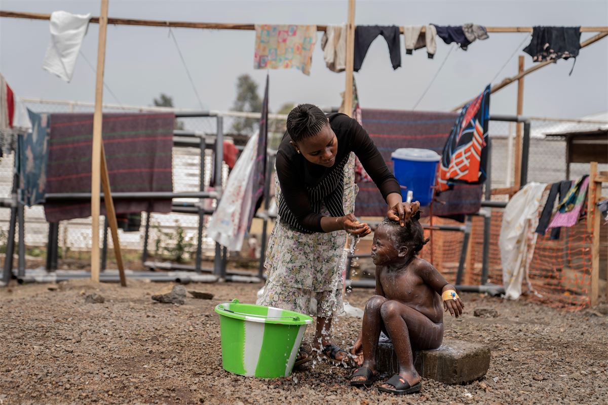 Cómo Europa está desempeñando un papel fundamental en la lucha contra la nueva variante del virus mpox