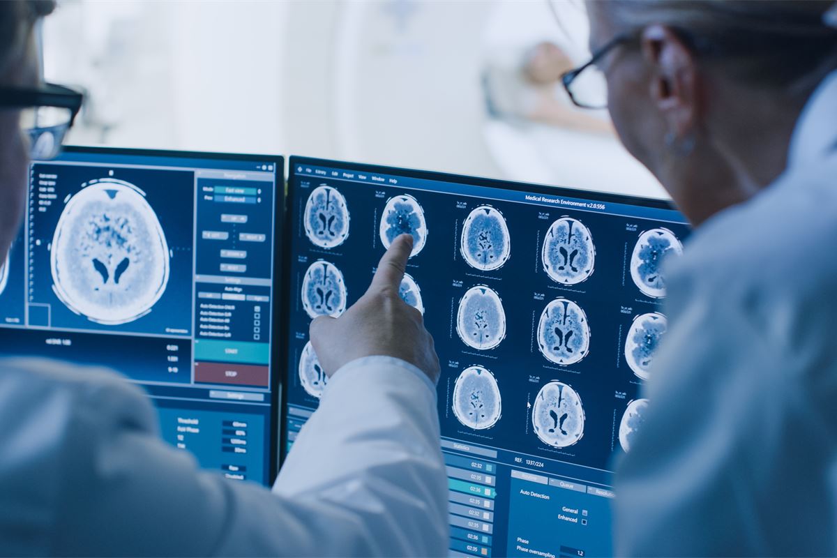 Hacia una estrategia europea para la salud del cerebro: ¿por qué es hora de actuar ahora?